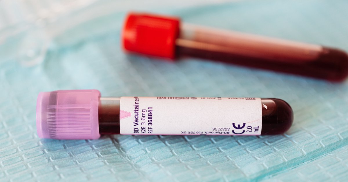 Anti TPO: τι είναι και ποια η σημασία του